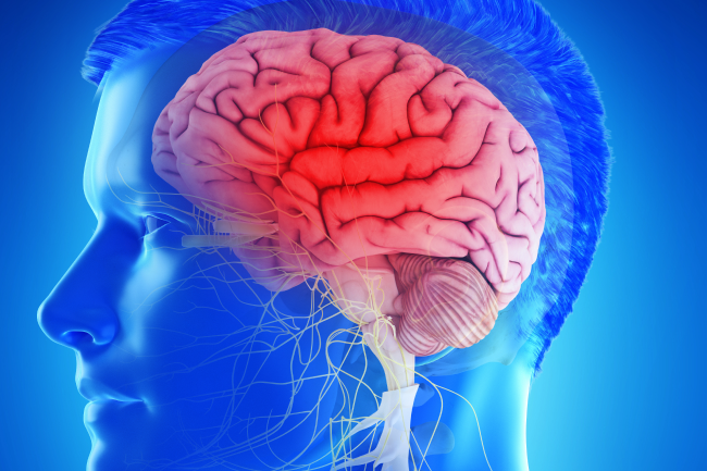 뇌혈관질환 재활 이미지